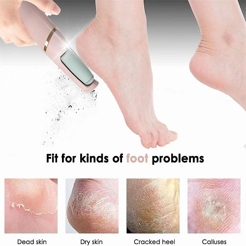 ShopNBuy | Electric Pedicure Foot File Callus Remover