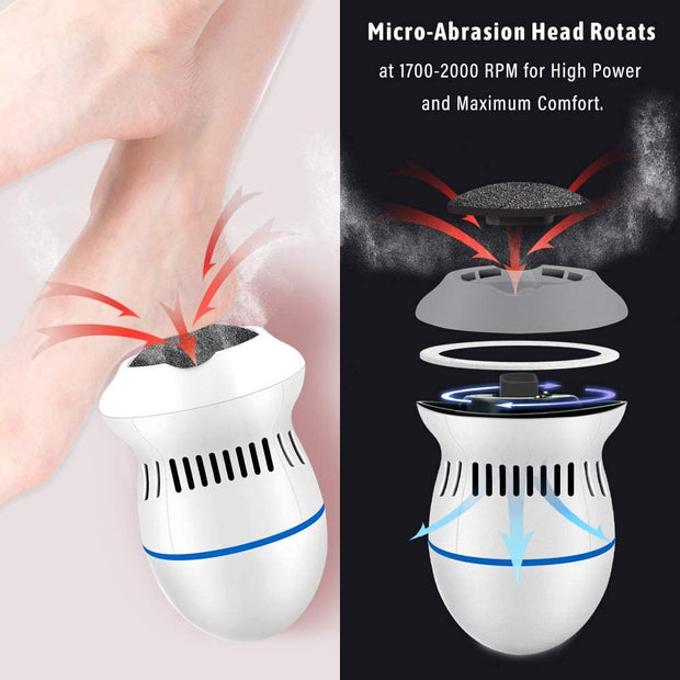 ShopNBuy | Electric Callus Remover