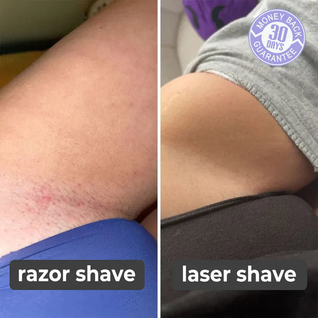 Painless Hair Remover